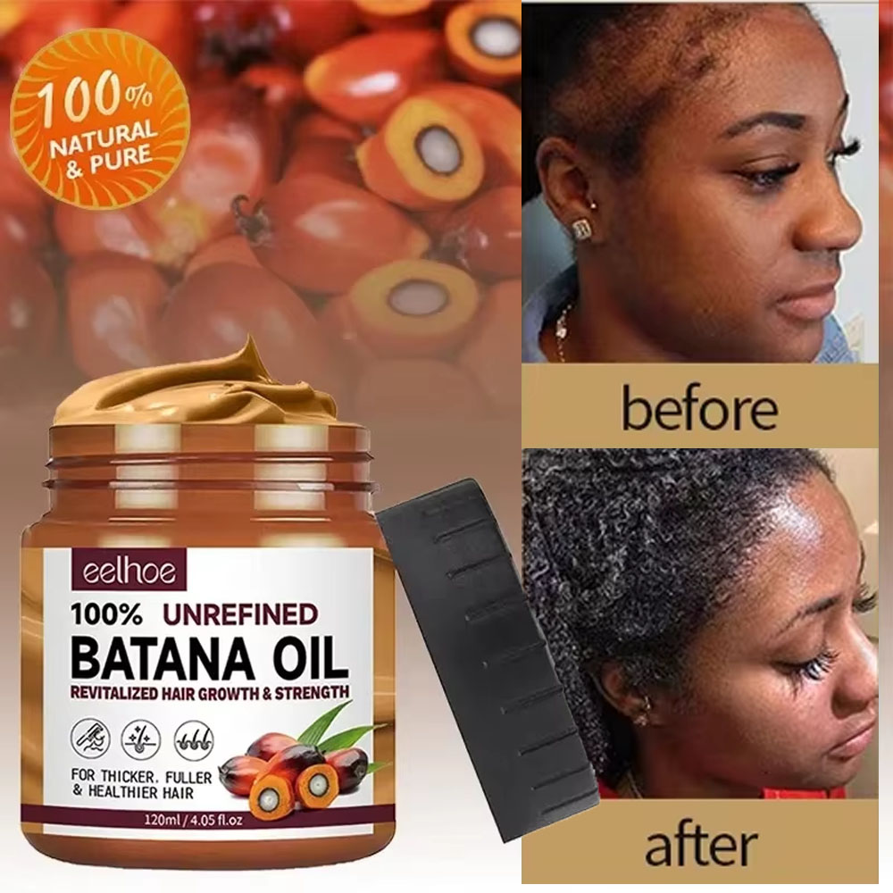 Bond Repair Shampoo - Batana Haarwachstumsöl, Spülung, Anti-Haarausfall-Produkte, schnell wachsende