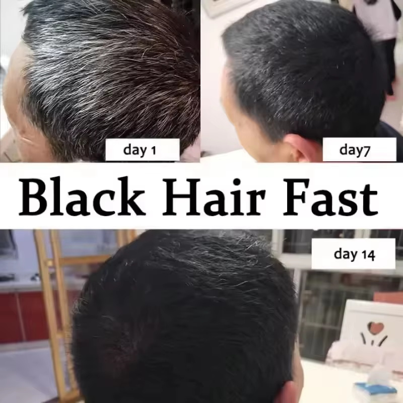 Grauweißes Haarbehandlungsseru – Hair Care Ginseng Bewertung und Preis