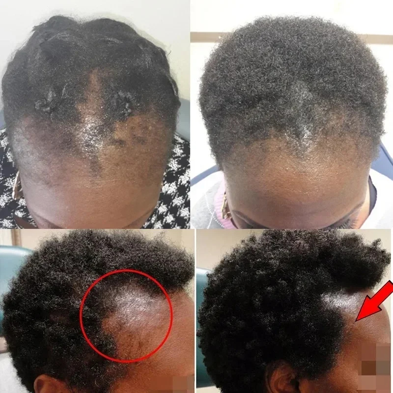 Batana Haarwachstumsöl, Spülun – Bond Repair Shampoo Bewertung und Preis