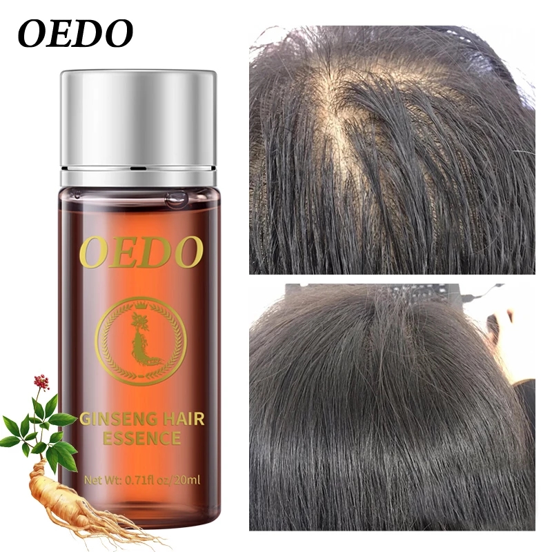20 ml Ginseng-Haarwachstumsess – Hair Care Ginseng Bewertung und Preis