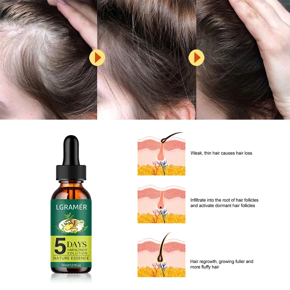 Haarwuchs-Essenzöl 5-Tage Ingw – Hair Care Ginseng Bewertung und Preis